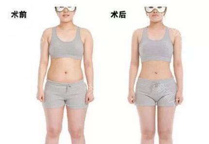 北京八大處雙眼皮手術(shù)選哪位專(zhuān)家非?？孔V