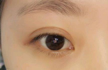 四川大學(xué)華西醫(yī)院整形科專家對比！李正勇、李繼華、肖海濤實力大PK！