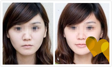 上海薇琳眼修復(fù)醫(yī)生推薦！多位經(jīng)驗(yàn)豐富的專家深受患者歡迎