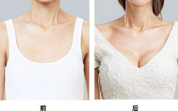 上海玫瑰醫(yī)療美容醫(yī)院李鴻君：讓您雙眼皮及翹睫擁有完美效果