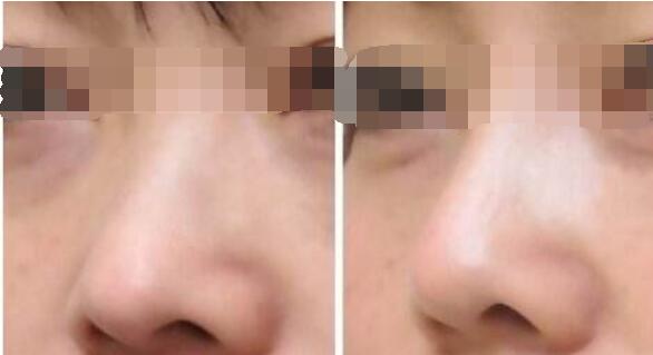 南京優(yōu)質(zhì)磨骨醫(yī)生推薦，最新磨骨醫(yī)生排名前五