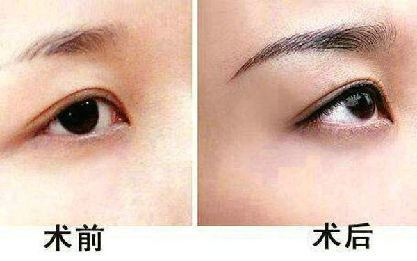北京隆胸醫(yī)生匯總！技術(shù)嫻熟超凡脫俗，排名翹楚刷新！