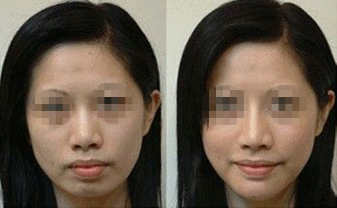徐士亮的鼻子美得讓人驚艷！解讀醫(yī)生的隆鼻技術及2023年最新整形價格表