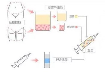 成都整容醫(yī)生綜合評測排名，李信奎、葉斌、靳小雷等備受好評！