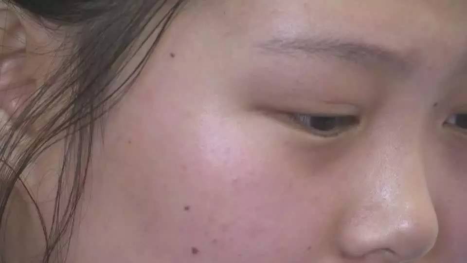 韓國棟隆胸在四川美萊整形醫(yī)院的狀況如何？
