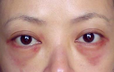 「李保鍇做鼻子的價格真高？試試醫(yī)生背景公開、最低售價1萬、隆鼻收費一覽表」