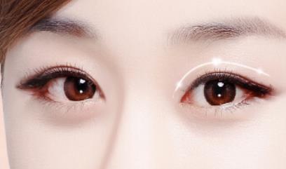 術(shù)后一周，吳中興成功完成正頜手術(shù)并順利恢復(fù)上班