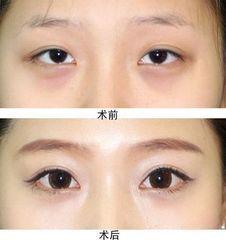北京紫潔仁雁醫(yī)療美容門診部彭紀(jì)湖院長匠心之美