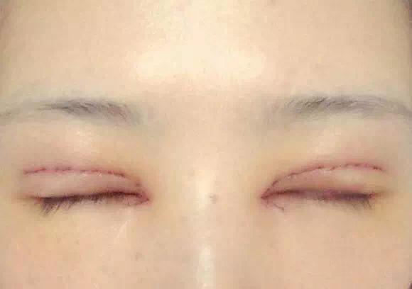 北京隆胸權(quán)威榜單揭曉！這3位專家實(shí)力超群，牽手完成完美隆胸
