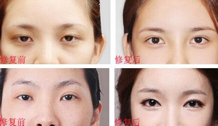 廣州曙光醫(yī)美：張晨醫(yī)師為您實現(xiàn)完美健康乳房