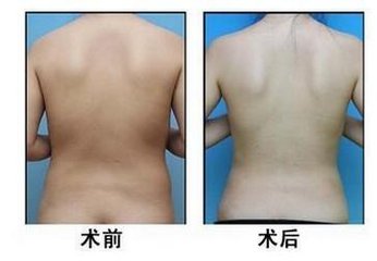 北京圣嘉新邱立東醫(yī)生如何預(yù)約？攜醫(yī)技術(shù)評(píng)估+2023年收費(fèi)細(xì)則