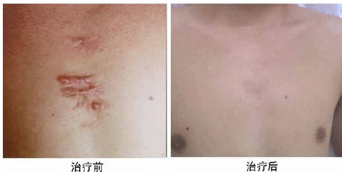 上海第九人民醫(yī)院名譽教授錢云良的工作時間及真實評價，助您了解更多！
