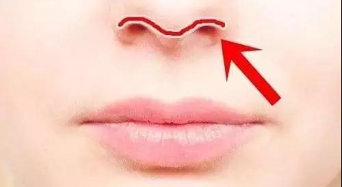 廣州南方醫(yī)院羅勇隆鼻手術(shù)效果及費(fèi)用詳解