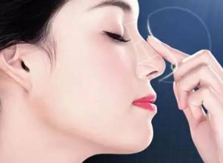 李鴻君氣鼓鼓的鼻子，專業(yè)點(diǎn)評(píng)與價(jià)格參考