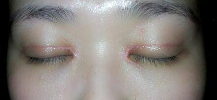 深圳美萊整形美容醫(yī)院：找到最適合你的整形醫(yī)生和熱門項(xiàng)目