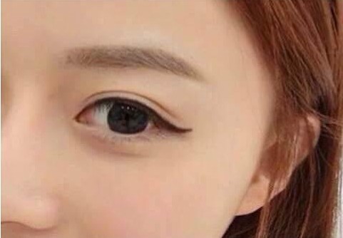 長沙瑞瀾整形：獲取完美鼻型的實用指南