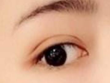 上海穆雄錚正頜修復(fù)綜述：輪廓修復(fù)價(jià)格及醫(yī)生掛號(hào)方式一覽，口碑實(shí)力搶先揭秘！