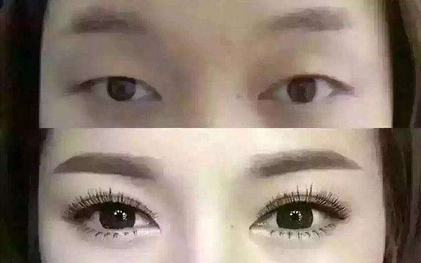 上海容妍湯學(xué)標(biāo)整形醫(yī)生點(diǎn)評(píng)鼻部整形效果及案例分享