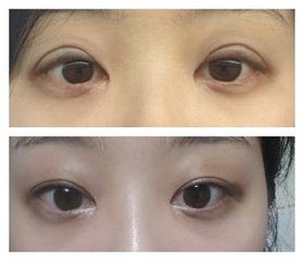北京臉部整形大師擔(dān)當(dāng)，技藝高超醫(yī)生名單全新揭曉