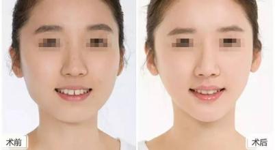 上海受歡迎的隆鼻專家：這3位醫(yī)生是權(quán)威且備受推崇的！