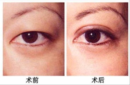 馬福順vs何照華：誰是磨骨技術(shù)領(lǐng)域的巨擘？