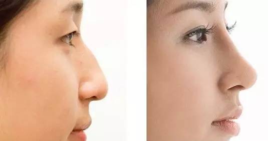 重慶抽脂醫(yī)生排名及手術(shù)價(jià)格一覽，5位專家在線解答！