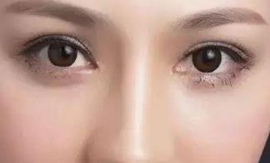 楊艷清在武漢第三醫(yī)院的隆鼻案例，令人自然萌感！