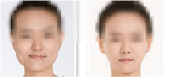 如何通過金尚訓(xùn)訓(xùn)練雕刻完美下頜角？短期效果令人驚嘆！