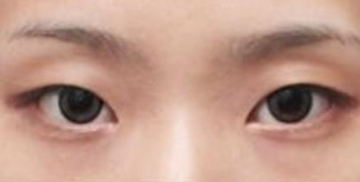 北京五大整鼻醫(yī)生，誰(shuí)是專家？薛志強(qiáng)、夏正義排名前列！