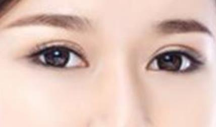 溫州三位頗具口碑的雙眼皮醫(yī)生排名及手術(shù)費(fèi)用公開，其中徐少駿等專家值得認(rèn)識！
