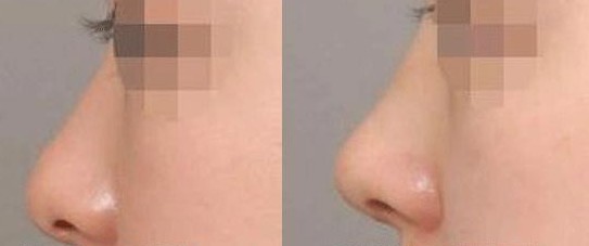 重慶華美眼部整形，數(shù)位醫(yī)生備受贊譽(yù)！