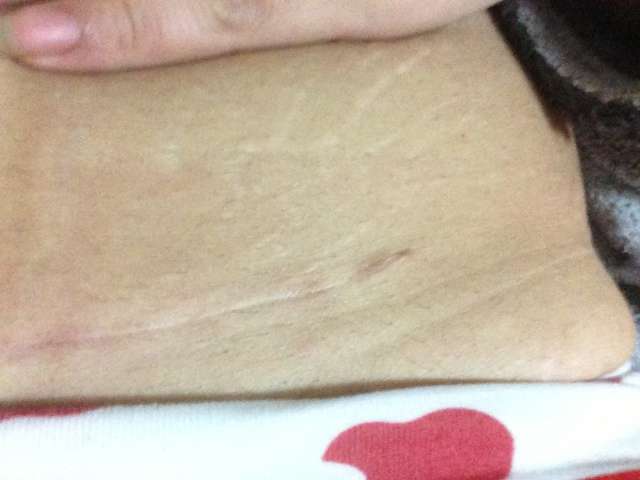 國內脂肪修復領域的專家排名公布！王紹國、孫波等震撼入圍前三，專業(yè)技藝多元化