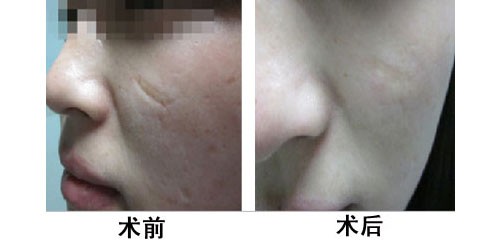南京五大眼部整形醫(yī)生值得關(guān)注！專家榜單揭曉