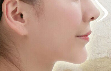 重慶整形醫(yī)生：揭秘當(dāng)代王旭明的鼻部整形案例及獨(dú)特風(fēng)格！