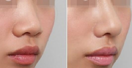 杭州格萊美醫(yī)療美容醫(yī)院，邀您見證王珊青的匠心之道