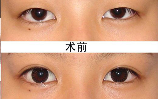 重慶鼻整形醫(yī)生排行榜揭曉！李任、黃鮮、劉江三位口碑非常好