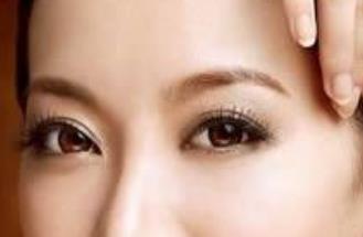 齊云香、王娟、趙成利雙眼皮二次整形案例詳解—醫(yī)生優(yōu)選指南