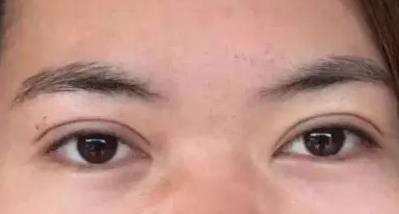 南方醫(yī)科大學珠江醫(yī)院杰出整形療效讓你驚喜不已