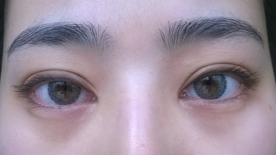 上海九院經(jīng)驗(yàn)豐富的隆鼻專家推薦！自然款隆鼻案例分享啦！