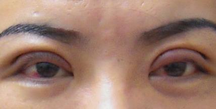 上海眼修復(fù)領(lǐng)域最新排名出爐：柴云、蘇薇潔、張余光悉數(shù)榮登！