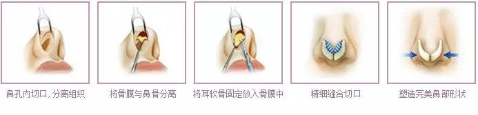 長沙三和整形醫(yī)院：專家胡珍瑜幫您徹底擺脫煩惱的皮膚疣！