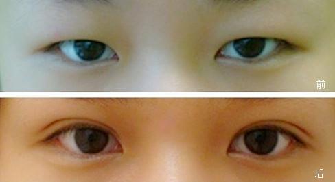 深圳有哪些出色的吸脂醫(yī)生？附醫(yī)生簡介與2023價格