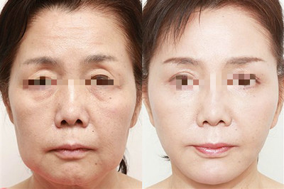 天津河?xùn)|美澤醫(yī)學(xué)美容?？崎T診部張杰：專注美膚、塑形與健康年輕化
