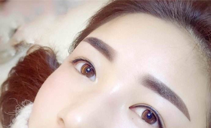 西南醫(yī)院肖海濤雙眼皮修復效果如何？附真實案例參考！