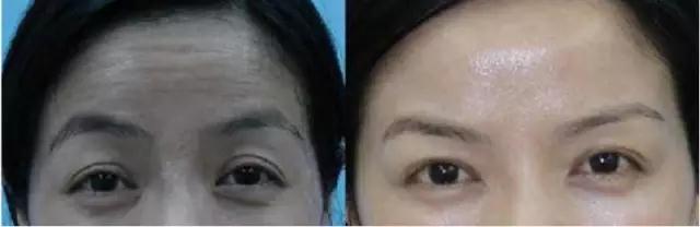 浙江省臺(tái)州醫(yī)院整形科醫(yī)生列表及費(fèi)用一覽！不容錯(cuò)過的專業(yè)整形醫(yī)生資源！