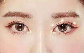 重慶麗格樊雯君醫(yī)生技術(shù)專業(yè)評(píng)測(cè)擅長(zhǎng)項(xiàng)目介紹