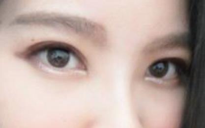杭州藝星神醫(yī)介紹，讓你完美獲得雙眼皮！附參考價(jià)格2023！