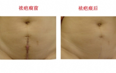 武漢郭亮整形醫(yī)生推薦，雙眼皮效果如何？完整分享醫(yī)生簡介和照片案例