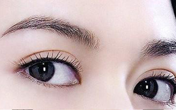 馮曉玲醫(yī)生在武漢協(xié)和醫(yī)院進行雙眼皮手術的效果如何？受歡迎的醫(yī)師案例分享，必看！