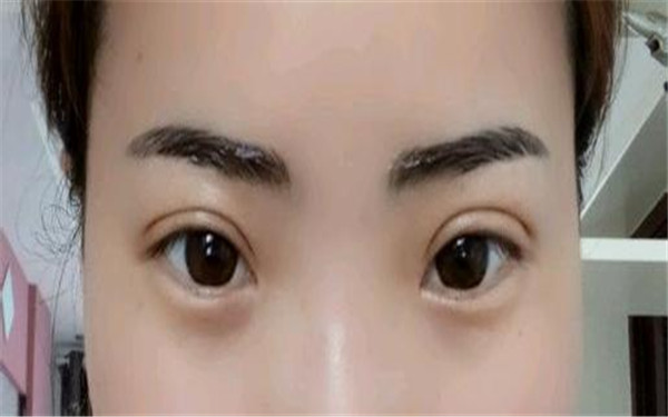 劉中國下巴整形醫(yī)師專業(yè)點(diǎn)評和手術(shù)風(fēng)格，推薦就診醫(yī)院